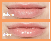 Lip oil bare before & after